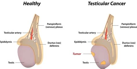 A dull ache or heavy sensation in the lower abdomen. Editor, Author at Human N Health : Human N Health