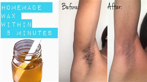 Remove the bowl from the oven and allow it to cool down to some extent. DIY SUGAR WAX FOR BEGINNERS FOR HAIR REMOVAL | SOUTH ...