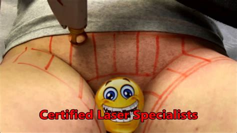 Very painful need to wait until hair is long … Professional Laser Hair Removal - Brazilian Bikini | Hair ...