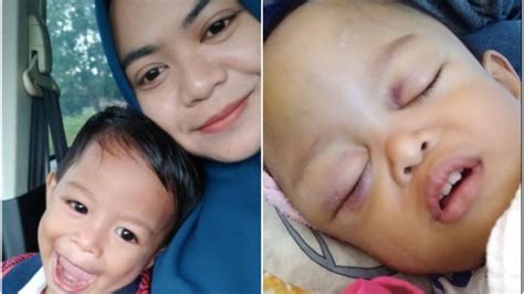 Jika cedera terjadi internal, biasanya akan muncul memar, benjolan atau pun kerusakan serius. Ibu Tak Sangka Terhantuk Biasa Menyebabkan Bayi Alami ...