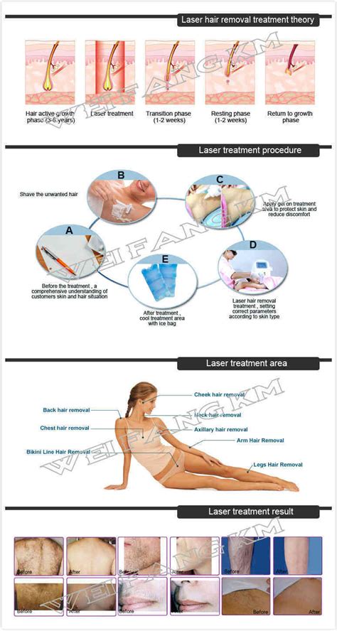 It's not a laser, but it too uses light and you can also shave in between sessions as you need. Super Fast Hair Removal 3 Wavelength Diode Laser Hair Removal