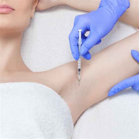 During the procedure, the doctor. Botox® for Excessive Sweating