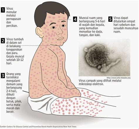 Check spelling or type a new query. Campak Rubella (Measles Rubella) - Pusat Imunisasi