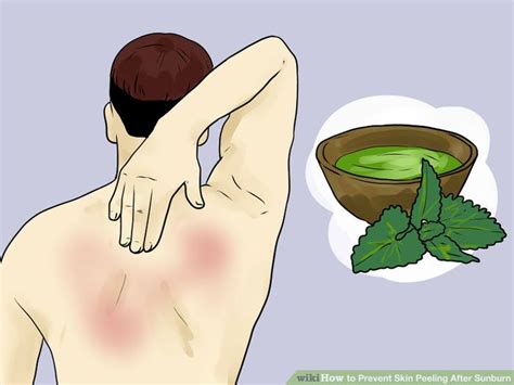 Putting your poster in a box or cabinet. Prevent Skin Peeling After Sunburn | Peeling skin, Prevent peeling sunburn, Coconut oil for sunburn