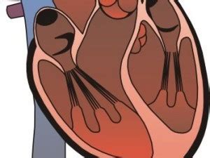 Eble will explain what myocarditis is. 7 Common Heart Problems and Symptoms | Healthhype.com
