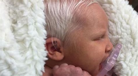 The baby boy born with white hair most of us have quite a bit of time to enjoy our youth and good looks before having to start worrying about age spots, wrinkles, saggy skin and grey hairs. √ This Is How This Baby Is Born With White Hair! The Nurse ...