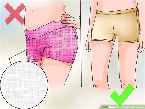 Whenever a problem arises in society, people invent a solution to it. 3 Ways to Prevent Camel Toe - wikiHow