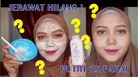 Hilangkan bekas jerawat merah dengan cara ini. TIPS HILANGKAN BEKAS JERAWAT DENGAN MASKER BEDAK BAYI ...