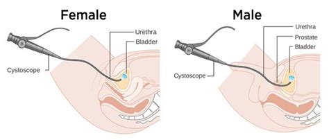 Its function is to enable reproduction of the species. Cystoscopy - Procedure for Visually Inspecting Bladder and ...