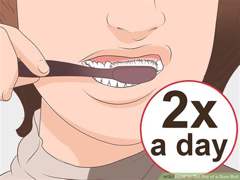 People wonder how your tooth begin to abscess and develop pus? How to Get Rid of a Gum Boil: 10 Steps (with Pictures ...
