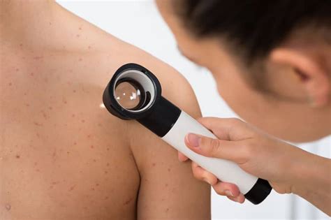 Should you wear sunscreen even when it's cloudy? Melanoma Skin Cancer - Early Detection, Causes, Prevention ...