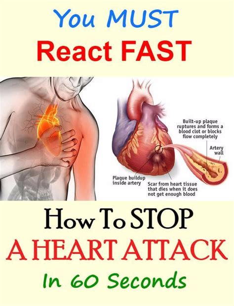 Stopping an initiated ddos attack is decidedly more difficult if your network is being attacked by a large number of dynamic hosts (greater than a hundred or thousand) it's much harder for a ddos to affect these content distribution networks and the cdns already know how to stop ddos attacks. HERE'S HOW TO STOP A HEART ATTACK IN 60 SECONDS, YOU MUST ...