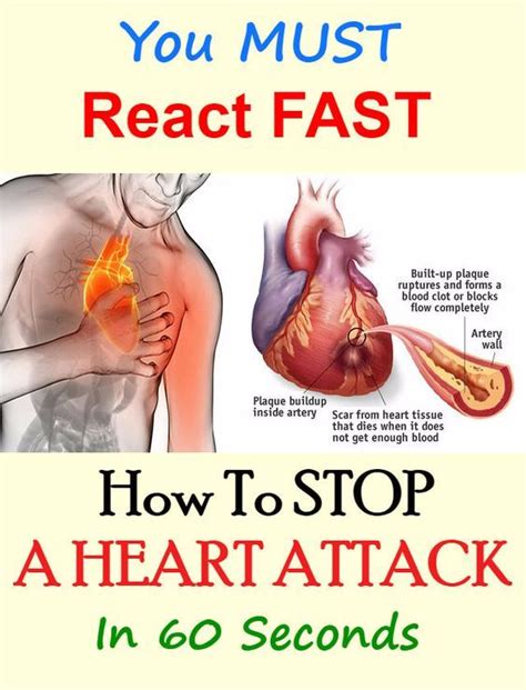 Stopping an initiated ddos attack is decidedly more difficult if your network is being attacked by a large number of dynamic hosts (greater than a hundred or thousand) it's much harder for a ddos to affect these content distribution networks and the cdns already know how to stop ddos attacks. HERE'S HOW TO STOP A HEART ATTACK IN 60 SECONDS, YOU MUST ...