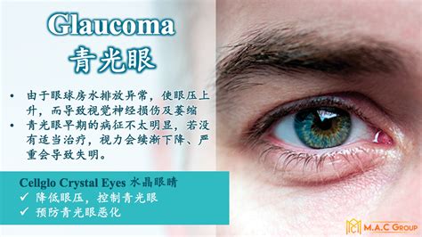 Cellglo crystal eyes provides the eye care you have been missing out on! 【Cellglo Crystal Eyes水晶眼睛】各种眼睛问题的救星!!