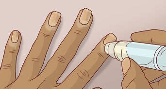 Removing ingrown nails and wound care for damage paw pads is an additional cost. How to Cut Your Fingernails and Toenails: 13 Steps (with ...