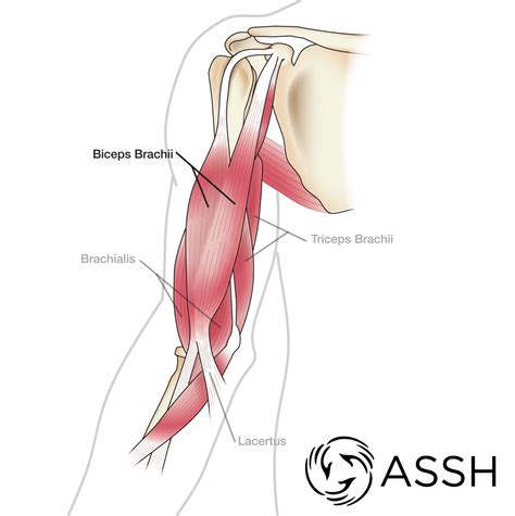 Your doctor or a physical therapist can recommend certain exercises that can help you get back to your normal routine. Body Anatomy: Upper Extremity Muscles | The Hand Society