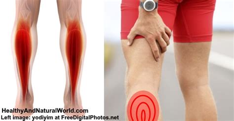 Muscle strains vary in severity depending on how much damage the muscle fibers sustain. Effective Treatments for Pulled, Strained or Torn Calf Muscle