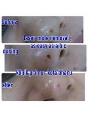 Find dentists in kota bharu. Klinik Primer Kota Bharu, Malaysia