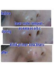 +60 9 743 91 11. Klinik Primer Kota Bharu, Malaysia