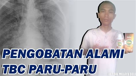 Cara memakai masker telur adalah kocok 1 telur ayam utuh bersama dengan 1 sendok makan minyak zaitun. Cara Menyembuhkan TBC Paru-Paru dengan Cepat - Pengobatan ...