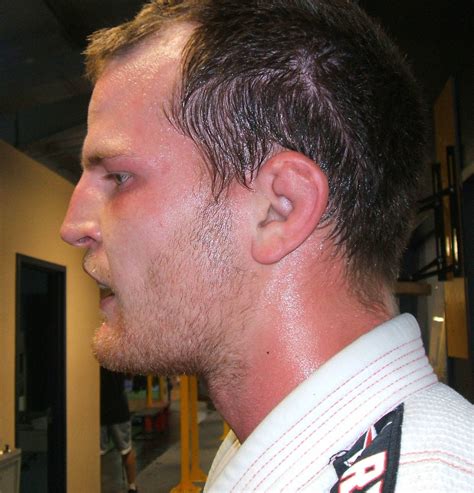 Turns out, your ears are pretty wonderful at regulating air pressure. How to Prevent and Treat Cauliflower Ear (and If It Means ...