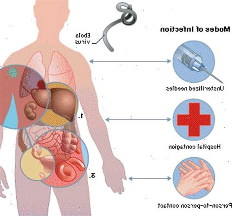 Los seres humanos pueden contraer los virus de animales infectados. Ebola-virus og Marburg-virus - Ojyn