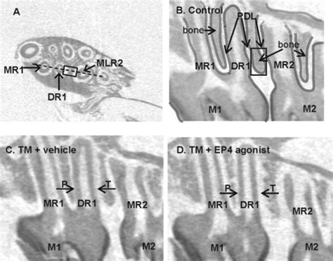 Setting to evaluate if a microscope and/or dental loupes. Bone formation and tooth movement are synergistically ...