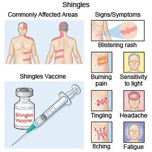 Shingles - What You Need to Know