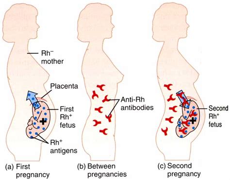 Dikutip dalam mayo clinic, penyebab bayi kuning saat lahir terjadi karena darah bayi mengandung kelebihan bilirubin yakni pigmen kuning sel darah merah. Biologi itu Bermanfaat Loh !: Sistem Peredaran Darah