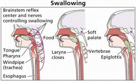 Swallowing issues related to multiple sclerosis are usually due to problems in the timing, or coordination,. Mary Mackey M.S. CCC-SLP: Sometimes It's Hard To Swallow