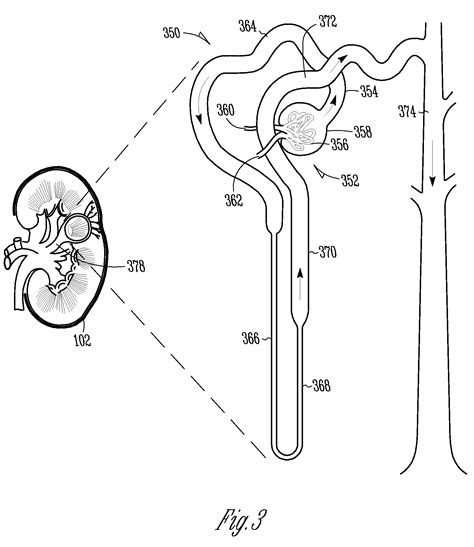 Touch device users, explore by touch or with swipe gestures. Excretory System Coloring Pages