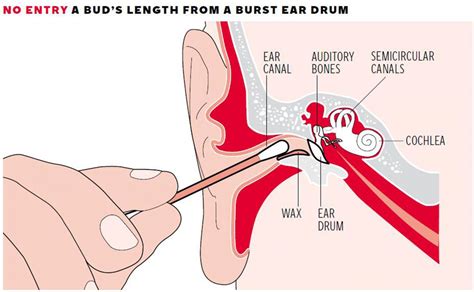 4 vs 1 (deepthroat, balls deep, hard, spank, spit). Natural Home Remedies For Ear Pain - How Get Rid Of ...