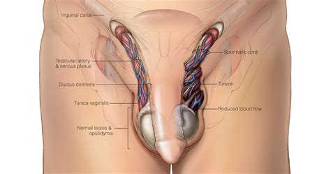 Artery to ductus deferens good:genital branch of genitofemoral nerve sleep: Question 5 - Epididymitis Question Bank - National STD ...