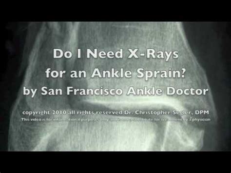 Maybe you would like to learn more about one of these? Do I need X-Rays for a Sprained Ankle by San Francisco ...