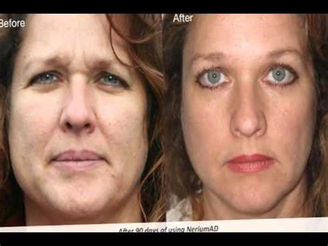 Artists paint pictures, taking into account the laws of anatomy and linear perspective. Nerium Before and After Pictures - NeriumAD Reviews - YouTube
