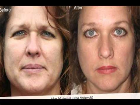 After compilations like these, we always want to look through our old photos and create the same before and after collages to see the changes. Nerium Before and After Pictures - NeriumAD Reviews - YouTube