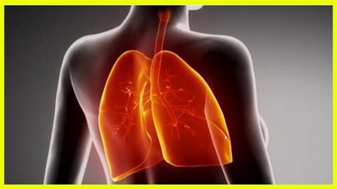 La fibrosis pulmonar es una enfermedad crónica en la que el tejido de los pulmones cicatriza y se vuelve grueso y duro, lo que produce en la actualidad no existe tratamiento curativo para la fibrosis pulmonar, pero cada vez son más los enfermos que se pueden controlar mediante medicamentos. Cómo mejorar naturalmente la fibrosis pulmonar - YouTube