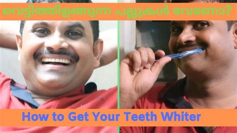 How to get rid of canker sores fast? വെട്ടിത്തിളങ്ങുന്ന പല്ലുകൾ വേണോ?/How to Whiten Teeth at ...
