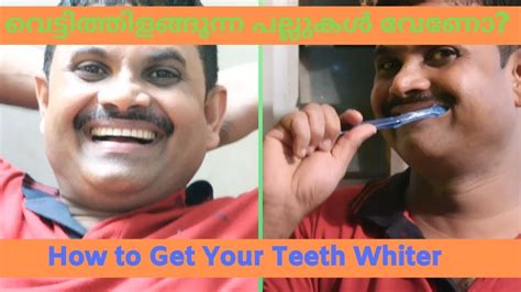 You can whiten your teeth at home with a whitening toothpaste, which may be enough to remove some surface stains. വെട്ടിത്തിളങ്ങുന്ന പല്ലുകൾ വേണോ?/How to Whiten Teeth at ...