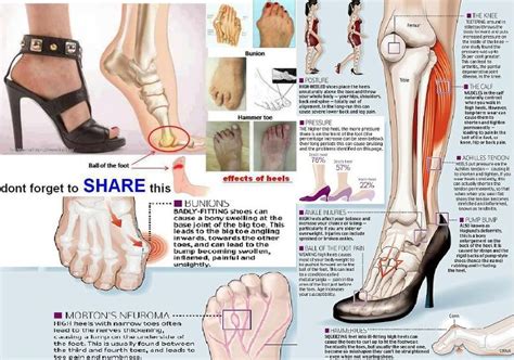 Sakit pada telapak kaki berikutnya bisa disebabkan oleh metatarsalgia. Mari Diet Dengan Shaklee: Sakit Tapak Kaki & Tumit