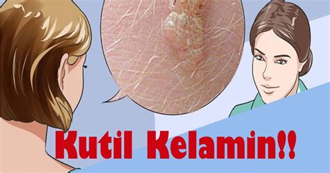 Harga obat ketuat kemaluan di cilacap. Ubat Kutil Di Tangan - Next Contoh