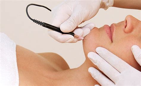 Yes,but in condition u have electrolysis hair removal machine and a person who is expert in it because it is one of the most painful ways of hair removal if you want to electrolyse water at home its possible. 5 Myths About Electrolysis Hair Removal, Debunked ...