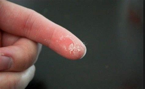 How to remove super glue from lips. Tricks on How to Remove Crazy Glue from Fingers | Super ...
