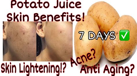 More images for how to use raw potato on face » How to get clear glowing skin using potato juice - YouTube