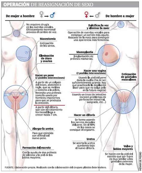 Check spelling or type a new query. Operacion Transgenero De Mujer A Hombre Genitales - sc ...