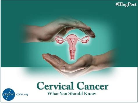 Cancer association of south africa 021 689 5347. Cervical Cancer and HPV: What Women Should Know | Pharm.com.ng