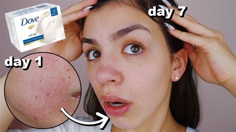 You may have a natural inclination to wash your face aggressively, thinking that it will help get rid of any oil and dirt and keep your face cleaner. I Used Dove Soap On My Skin Everyday For One Week - YouTube