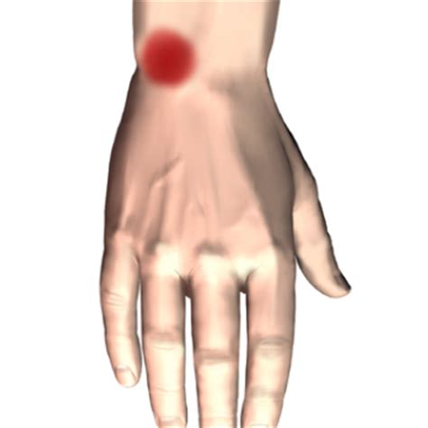 Patient Education | Central Orthopedic Group