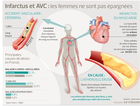 Nos hôtes avaient bien la mine de charbonniers, mais la maison ressemblait à un arsenal. Surveiller et traiter différemment le cœur des femmes