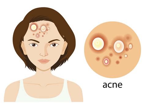 Namun, kini kita bisa mengeceknya dengan alat tes kehamilan bila merasakan indikasi hamil, jadi manfaatkanlah alat tes kehamilan. Tanda-Tanda Hamil : Yang dialami, Cek Awal, Pemeriksaan ...